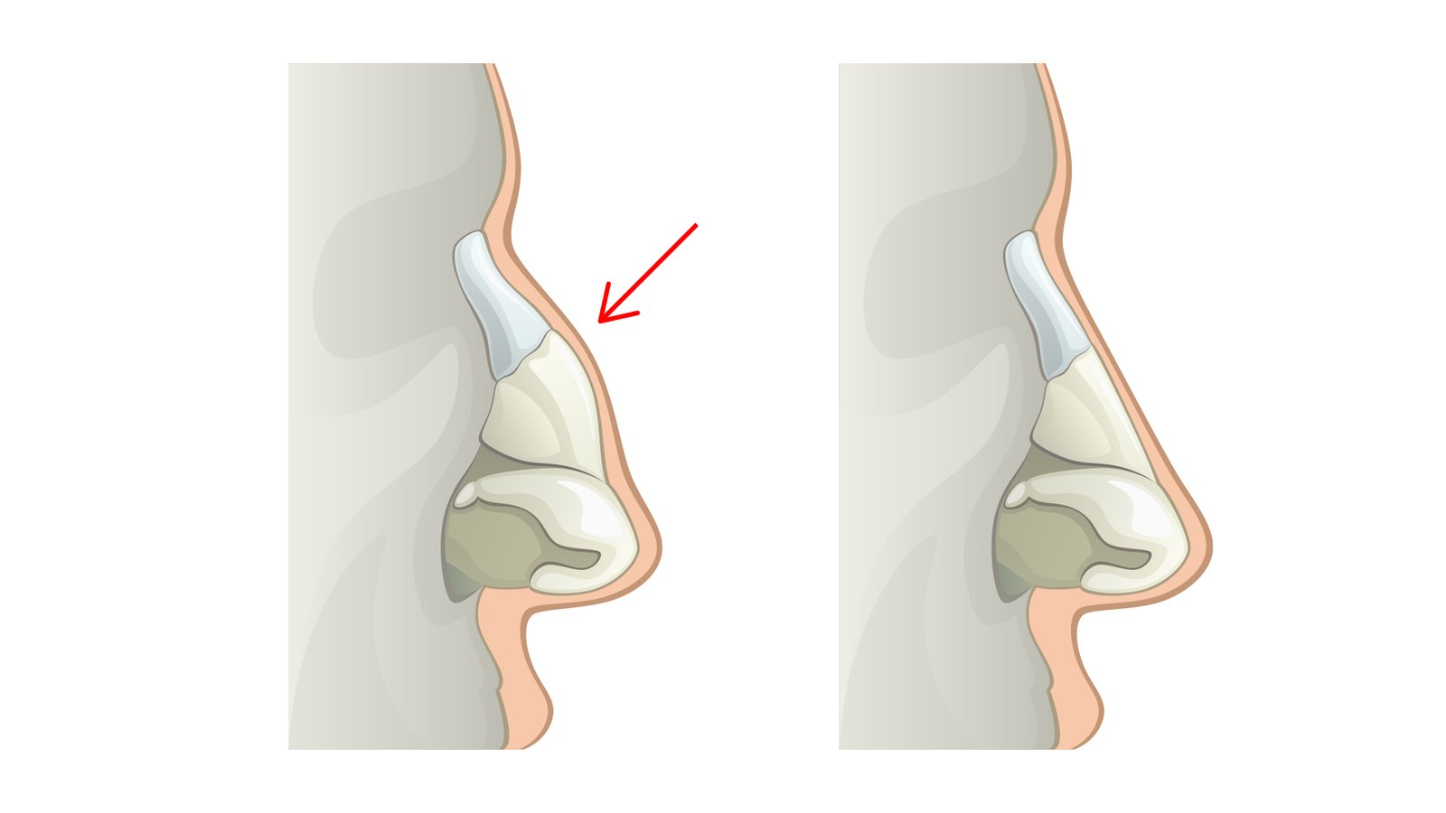Lesson 13 I How to Draw a Nose Lillian Gray Art School